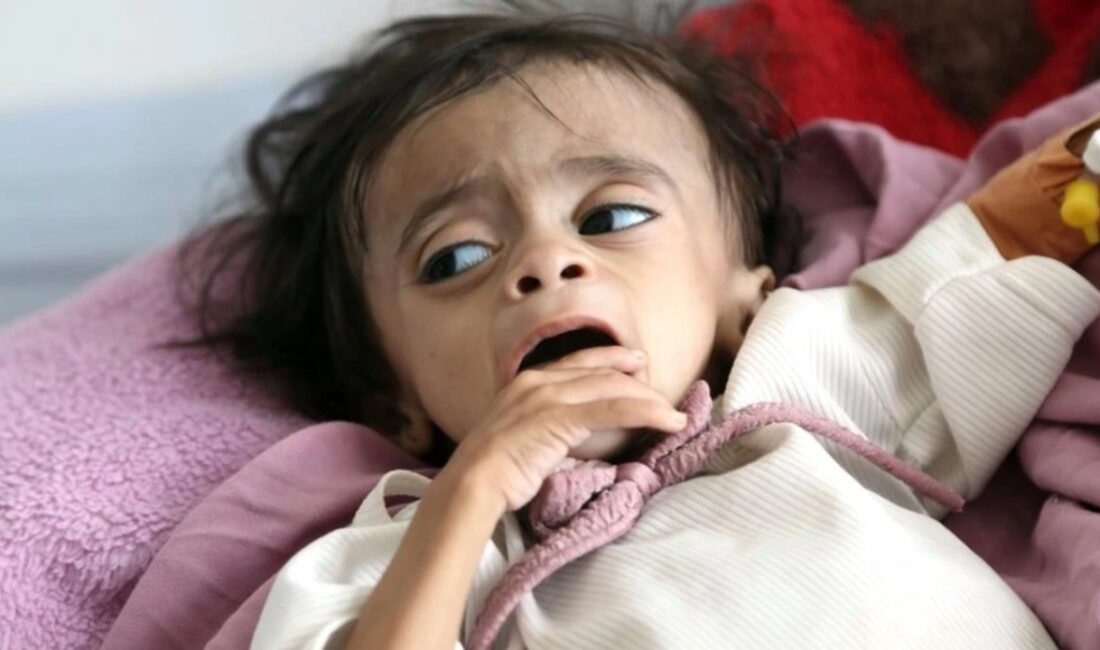 Avrupa Birliği, Yemen'deki insani krize yanıt olarak ülkeye ek kaynak