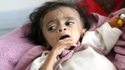 Avrupa Birliği, Yemen'deki insani krize yanıt olarak ülkeye ek kaynak